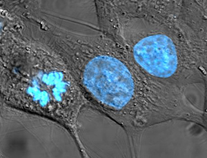 HeLa Cells