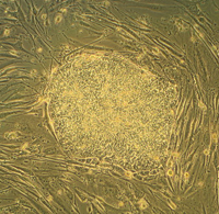 Human Embryonic Stem Cell (Wikipedia Commons)